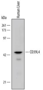 ENTPD5 Antibody in Western Blot (WB)