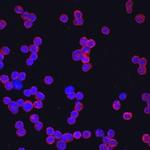 Il13ra2 Antibody in Immunocytochemistry (ICC/IF)