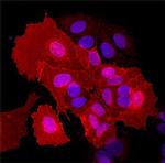 EphA5 Antibody in Immunocytochemistry (ICC/IF)