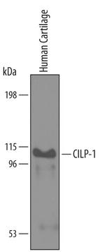 CILP Antibody in Western Blot (WB)