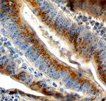 FUT8 Antibody in Immunohistochemistry (Paraffin) (IHC (P))