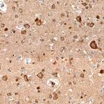 SEMA4C Antibody in Immunohistochemistry (Paraffin) (IHC (P))