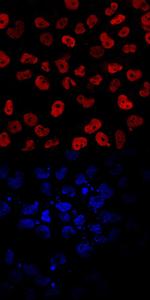 EOMES Antibody in Immunocytochemistry (ICC/IF)