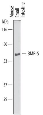 BMP-5 Antibody in Western Blot (WB)