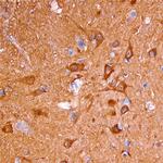 Neurocan Antibody in Immunohistochemistry (Paraffin) (IHC (P))