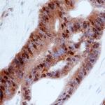 ITGB1BP1 Antibody in Immunohistochemistry (Paraffin) (IHC (P))