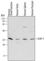 ITGB1BP1 Antibody in Western Blot (WB)