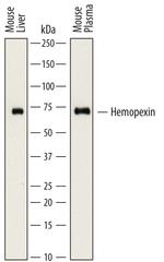 Hemopexin Antibody in Western Blot (WB)