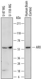 ARX Antibody in Western Blot (WB)