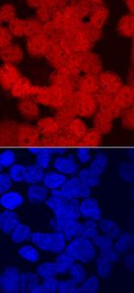 CRX Antibody in Immunocytochemistry (ICC/IF)