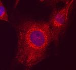 MAGI2 Antibody in Immunocytochemistry (ICC/IF)