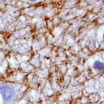 MAGI2 Antibody in Immunohistochemistry (Paraffin) (IHC (P))