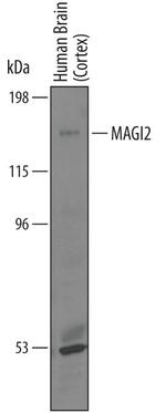 MAGI2 Antibody in Western Blot (WB)