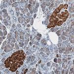 SLC30A8 Antibody in Immunohistochemistry (Paraffin) (IHC (P))