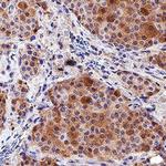 GREM1 Antibody in Immunohistochemistry (Paraffin) (IHC (P))