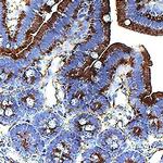 GAS6 Antibody in Immunohistochemistry (Paraffin) (IHC (P))