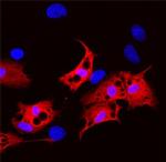 FABP2 Antibody in Immunocytochemistry (ICC/IF)