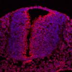 MCFD2 Antibody in Immunohistochemistry (Frozen) (IHC (F))