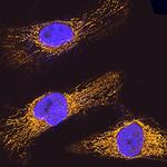 HSPA9 Antibody in Immunocytochemistry (ICC/IF)