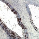 HSPA9 Antibody in Immunohistochemistry (Paraffin) (IHC (P))