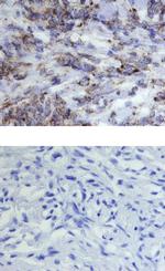 HSPA9 Antibody in Immunohistochemistry (Paraffin) (IHC (P))