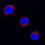 SOCS5 Antibody in Immunocytochemistry (ICC/IF)