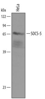 SOCS5 Antibody in Western Blot (WB)