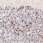 DACH2 Antibody in Immunohistochemistry (Frozen) (IHC (F))