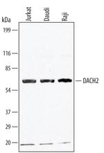 DACH2 Antibody in Western Blot (WB)