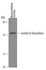 GBA3 Antibody in Western Blot (WB)