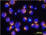 AIF Antibody in Immunocytochemistry (ICC/IF)