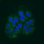 AIF Antibody in Immunocytochemistry (ICC/IF)