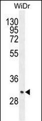 ZC4H2 Antibody in Western Blot (WB)