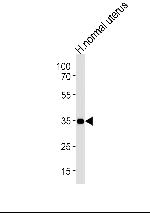 CUZD1 Antibody in Western Blot (WB)