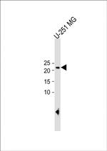 ECAT1 Antibody in Western Blot (WB)