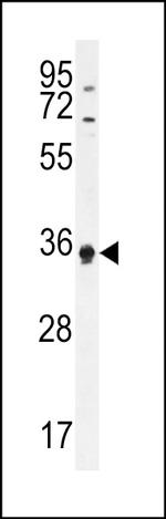 ECAT1 Antibody in Western Blot (WB)