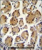 UBD Antibody in Immunohistochemistry (Paraffin) (IHC (P))