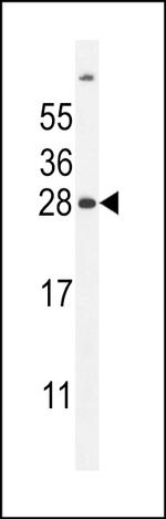 UBD Antibody in Western Blot (WB)