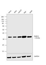 RAB12 Antibody in Western Blot (WB)