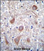 PTCHD1 Antibody in Immunohistochemistry (Paraffin) (IHC (P))