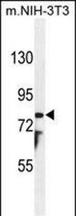 PTCHD1 Antibody in Western Blot (WB)