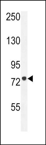 CPT1C Antibody in Western Blot (WB)