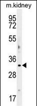 OBFC2B Antibody in Western Blot (WB)