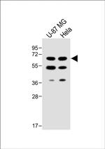 UGT8 Antibody in Western Blot (WB)