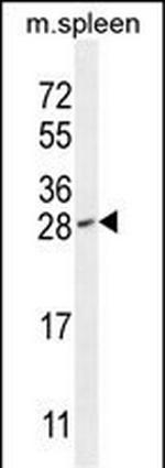 IAH1 Antibody in Western Blot (WB)