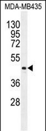 LIPK Antibody in Western Blot (WB)