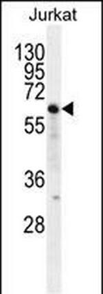 Naked2 Antibody in Western Blot (WB)