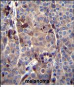 PRAMEF8 Antibody in Immunohistochemistry (Paraffin) (IHC (P))