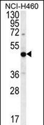 PRAMEF8 Antibody in Western Blot (WB)