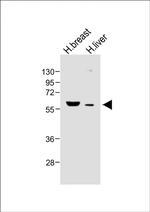 FADS2 Antibody in Western Blot (WB)